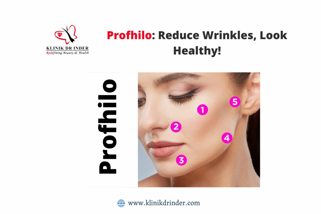 profhilo treatment